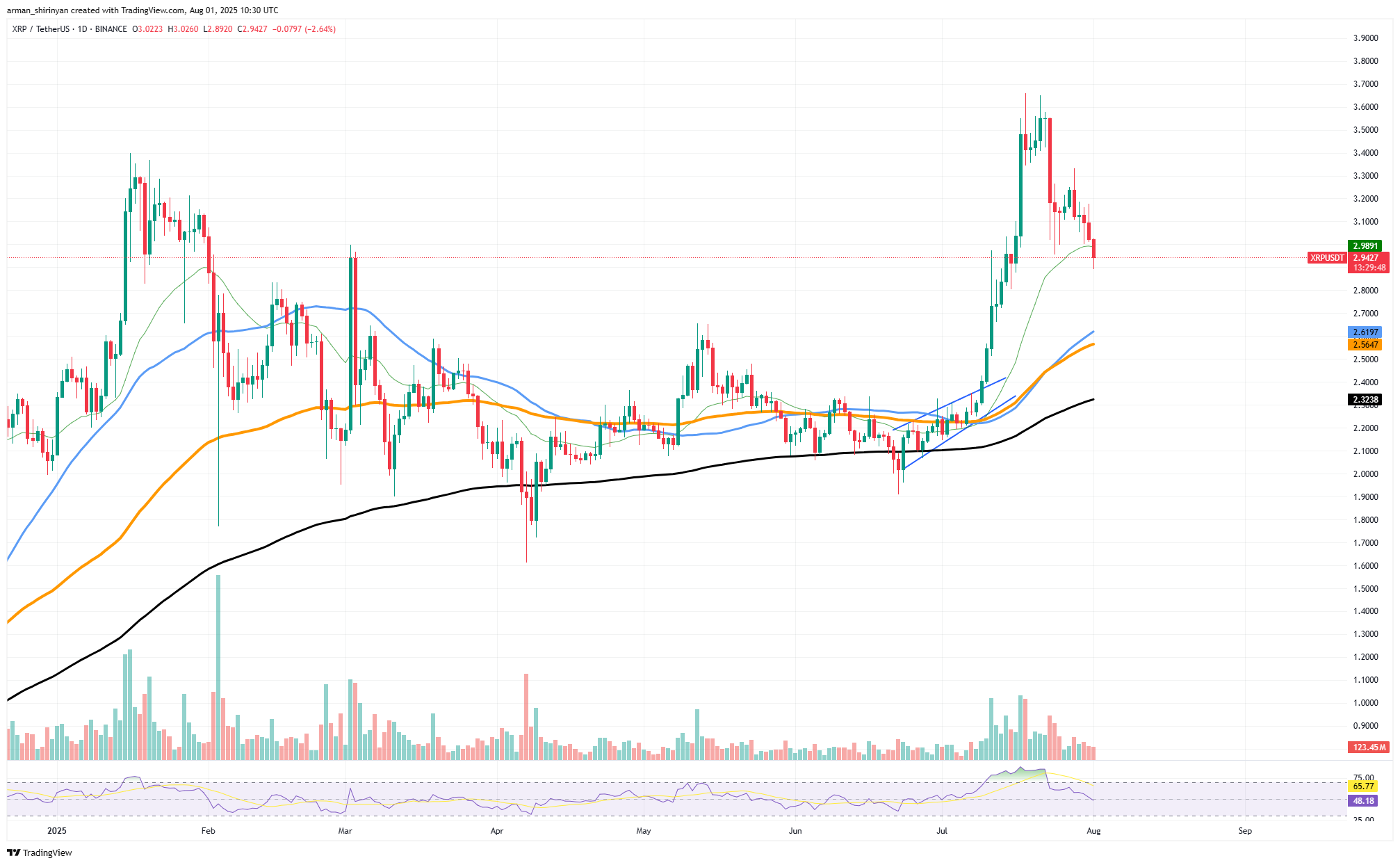 XRP Dips Below $3 Amid High On-Chain Activity, Suggesting Potential Consolidation Phase 1 Article image